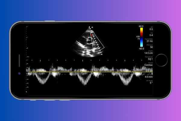 aplicativo-para-fazer-ultrassom